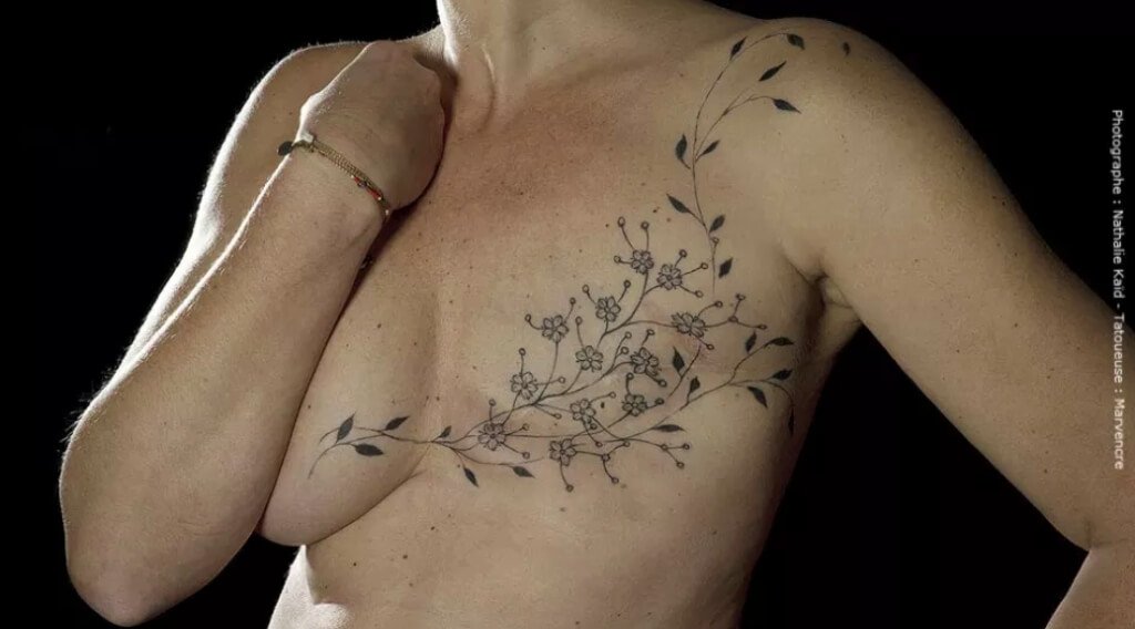 Quel tatouage après une mastectomie ? Comparaison entre le Tatouage 3D et le Tatouage artistique